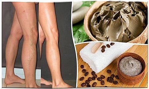 5 natural ways to fight varicose veins