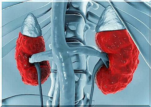 Proximal renal tubular acidosis.