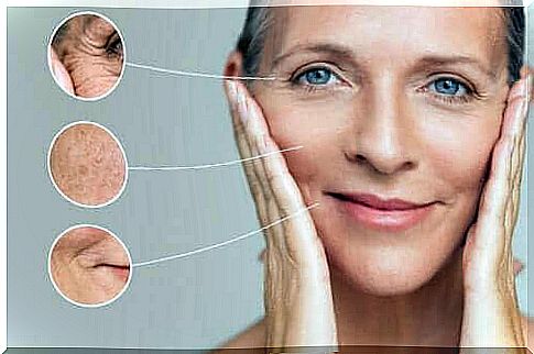 Different types of wrinkles and causes of them