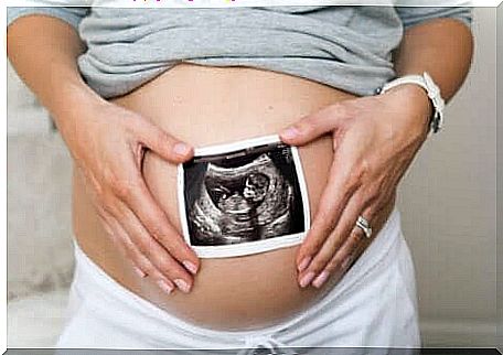 A pregnant woman.