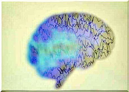 An EEG of the brain.