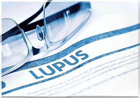 The word lupus on a sheet.