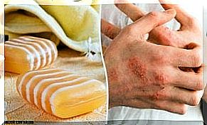 Homemade soap to fight dermatitis