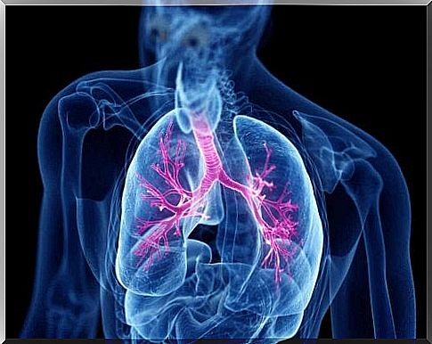 An X-ray of the lungs.