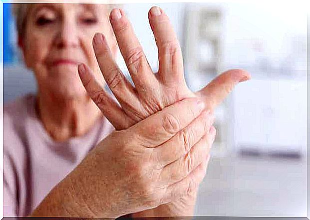 A woman with arthritis