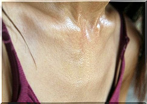 There is good advice against excessive sweating