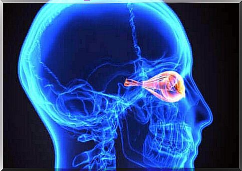 Optic neuritis or Devic's disease: What is it?