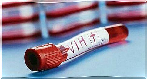 HIV-positive blood