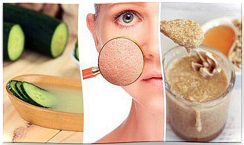 You can shrink your pores with these 5 natural treatments